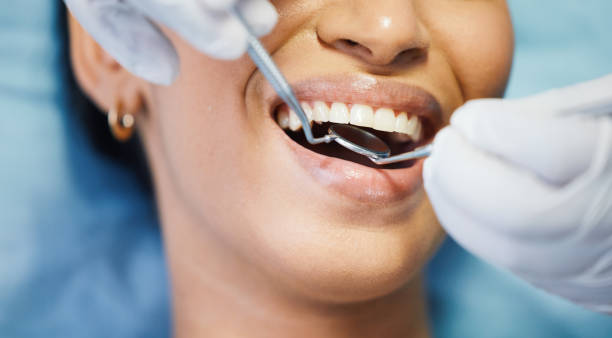 Best Emergency Wisdom Teeth Removal in Atlantic City, NJ